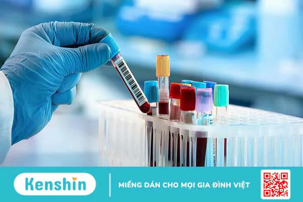 10 Xét nghiệm dấu ấn ung thư quan trọng bạn nên làm 1