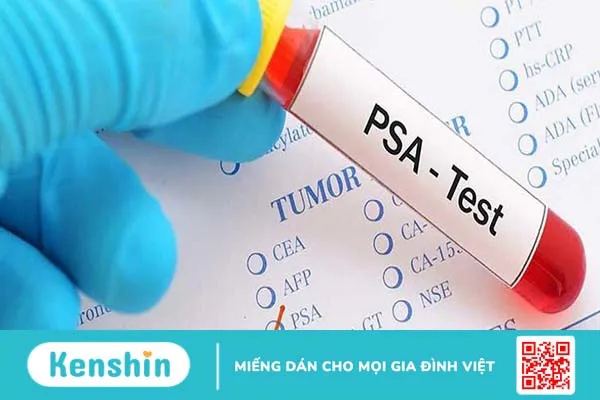 10 Xét nghiệm dấu ấn ung thư quan trọng bạn nên làm 2