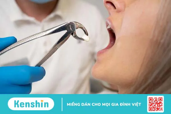 17 tuổi nhổ răng có mọc lại không? Nên làm gì khi mất răng? 1