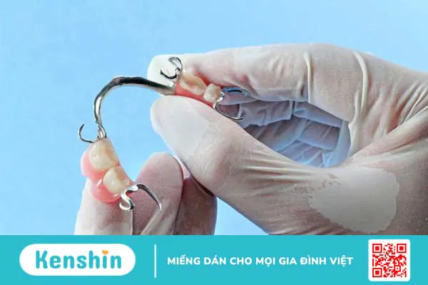 17 tuổi nhổ răng có mọc lại không? Nên làm gì khi mất răng? 3