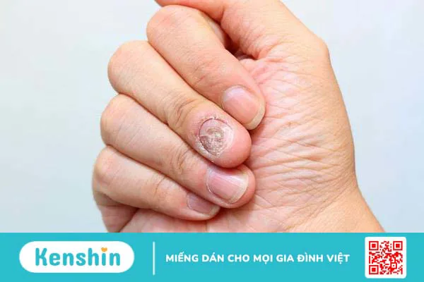 6 lý do khiến tay bạn có mùi và cách ngăn chặn hôi tay hiệu quả 3