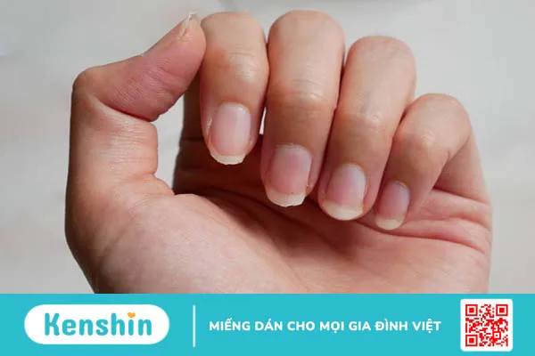 7 bộ phận trên cơ thể ‘tố cáo’ tuổi tác của bạn 2