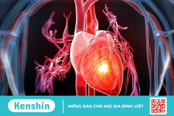 Sử dụng vitamin C giúp phòng chống nguy cơ mắc bệnh tim mạch