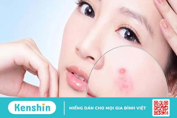 9 tác hại của quả lựu không phải ai cũng biết 3