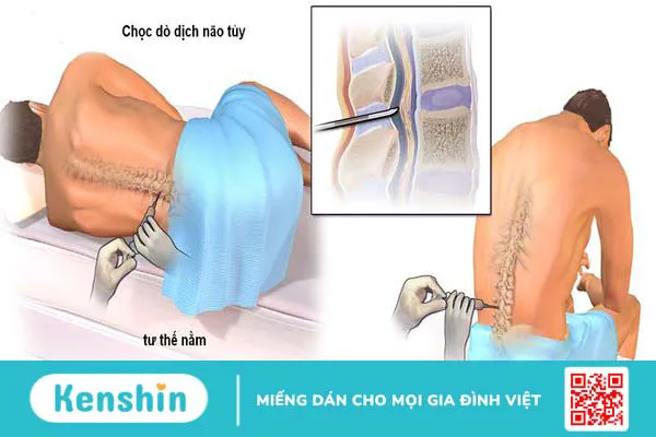 Amip ăn não lây nhiễm sang người như thế nào? Cách dự phòng bệnh 4