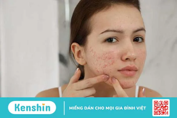 Ăn lê có nổi mụn không? Có khiến nóng trong người không?  2