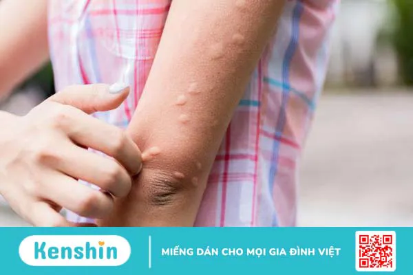 Ăn nhiều việt quất có tốt không? Có nên ăn mỗi ngày 4