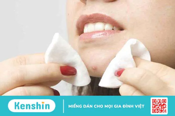 Bà bầu có được nặn mụn không là thắc mắc của nhiều người