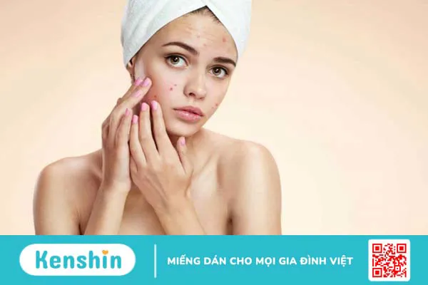 Bạn cần lưu ý gì trong điều trị sẹo lõm?2