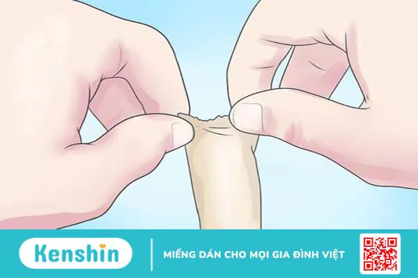 Bao nhiêu tuổi thì cắt bao quy đầu? Cắt bao quy đầu có gây nguy hiểm không? 4