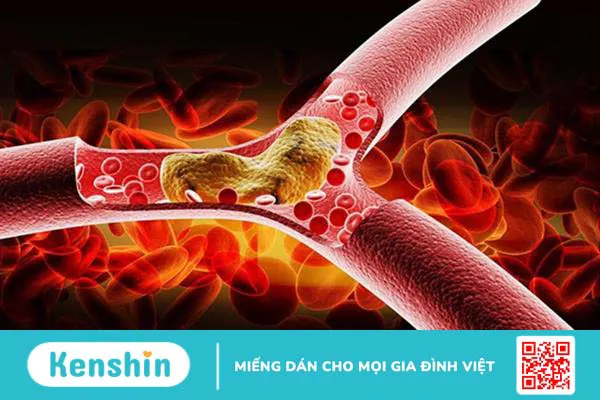 Bật mí cách uống lá sen khô giảm mỡ máu đơn giản và hiệu quả