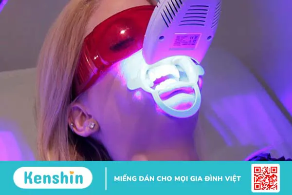 Làm trắng răng bằng laser tại phòng nha