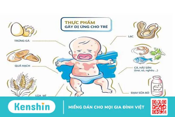 Bé bị phát ban nhưng không sốt có nguy hiểm không và những cách xử lý mẹ cần biết 2