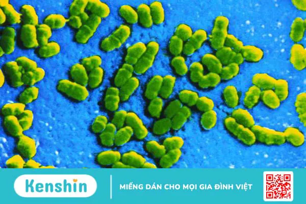 Bệnh Brucellosis: Những thông tin quan trọng cần biết 1