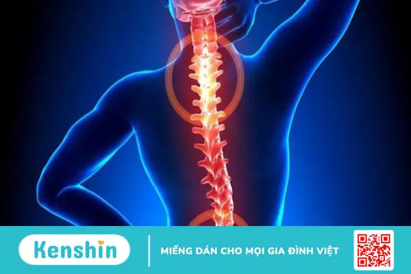 Bệnh rễ thần kinh thắt lưng: Nguyên nhân, triệu chứng và cách khắc phục 4