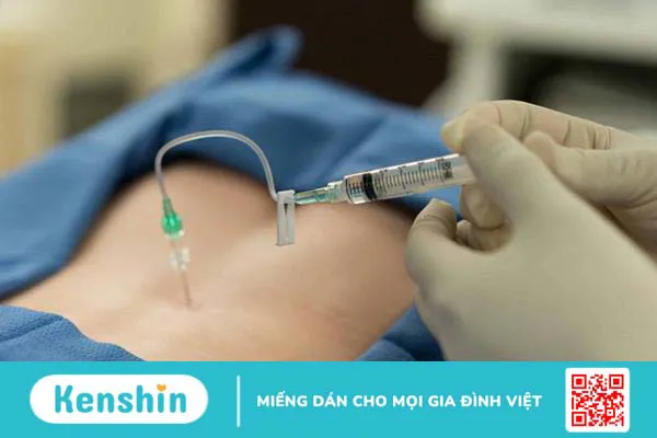 Bệnh rễ thần kinh thắt lưng: Nguyên nhân, triệu chứng và cách khắc phục 5