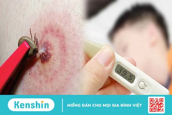 Bệnh Rickettsial là gì? Dấu hiệu nhận biết và cách phòng tránh bạn cần biết 3