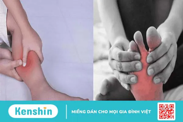 Bệnh teo cơ mác: Nguyên nhân, triệu chứng và cách điều trị 3