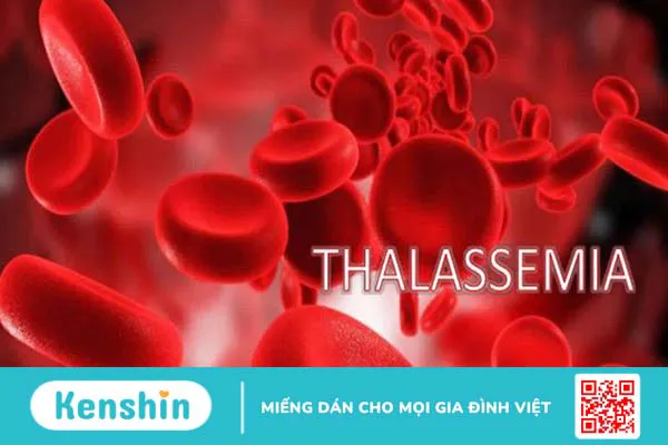 Bệnh thalassemia thể ẩn có ảnh hưởng đến sức khỏe không?1