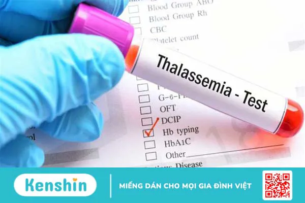 Bệnh thalassemia thể ẩn có ảnh hưởng đến sức khỏe không?3