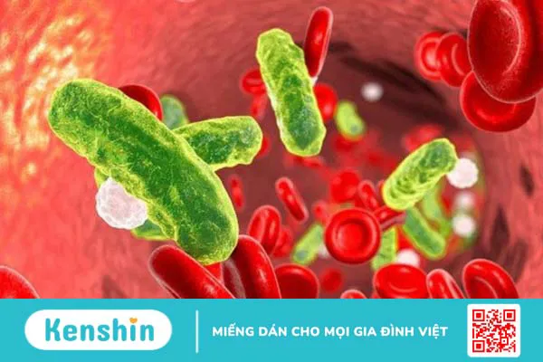 Bệnh viêm màng não mủ có chữa được không Có thể để lại di chứng gì 3