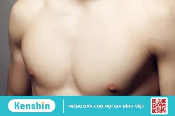 Bệnh vú to ở nam giới: Nguyên nhân và cách điều trị 1