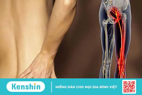 Bị đau thần kinh tọa có nên đạp xe không? 1