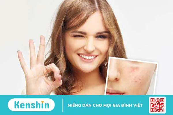 Bị mụn viêm có nên đắp mặt nạ đất sét không 4