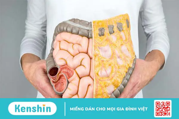 Bioflora 100mg uống trước hay sau ăn tốt hơn? Lưu ý khi dùng Bioflora 1