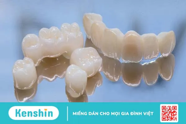 Bọc răng sứ 4 răng cửa giá bao nhiêu? Nên bọc loại nào tốt? 4