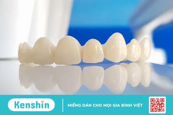 Bọc răng sứ mất bao lâu để hoàn thành? 2