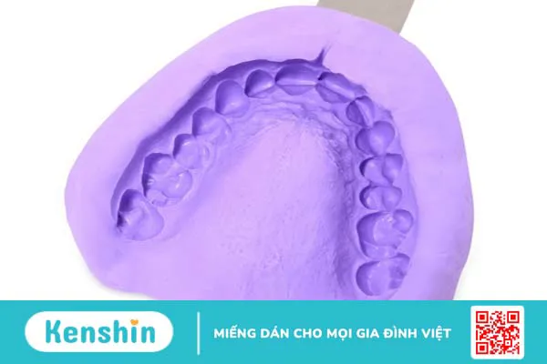 Bọc răng sứ mất bao lâu để hoàn thành? 3