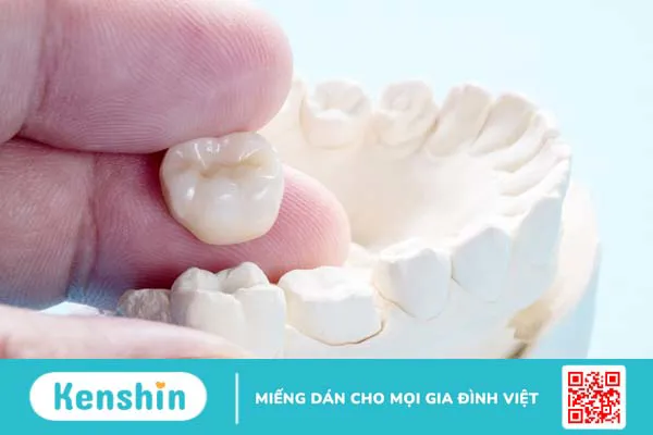 Bọc răng sứ nguyên hàm giá bao nhiêu tiền? So sánh ưu nhược điểm từng loại 3