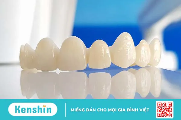 Bọc răng sứ nguyên hàm giá bao nhiêu tiền? So sánh ưu nhược điểm từng loại 4