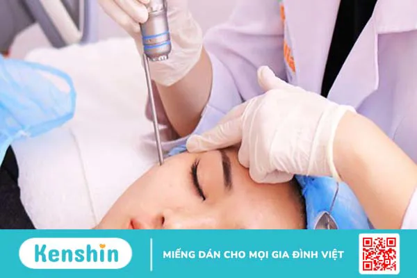 Bớt hori: Nguyên nhân, triệu chứng và cách điều trị 4