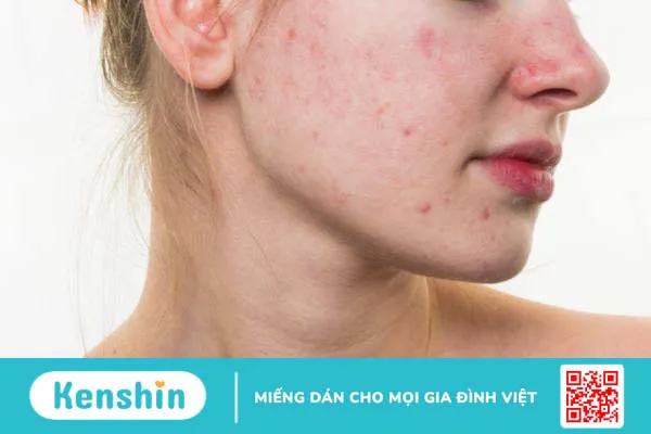 Các bước chăm sóc da bằng ánh sáng sinh học phổ biến hiện nay 2