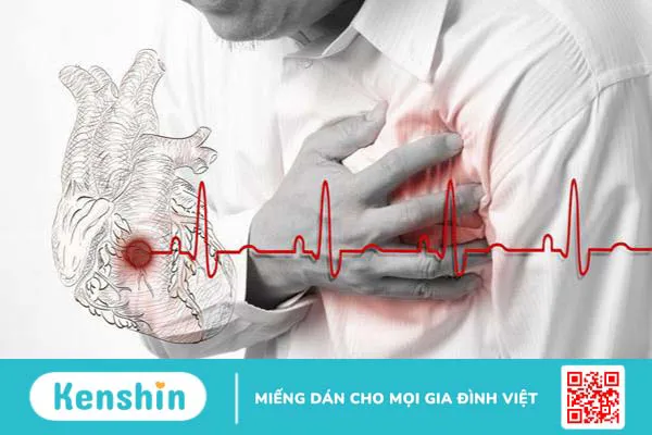 Các di chứng tai biến mạch máu não thường gặp là gì? 2