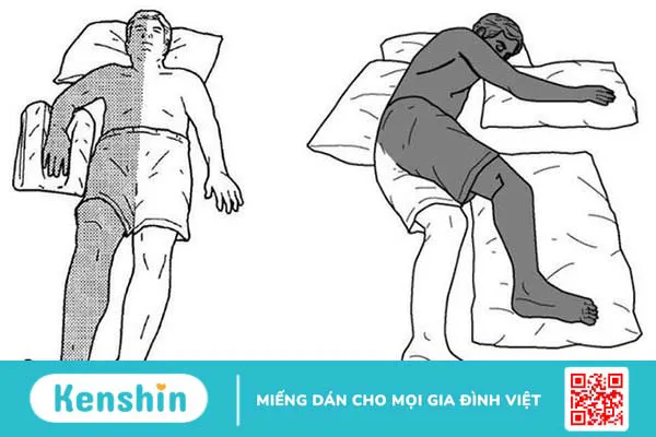 Các di chứng tai biến mạch máu não thường gặp là gì? 3