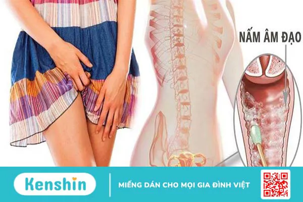 Các loại nấm gây bệnh trên người -3