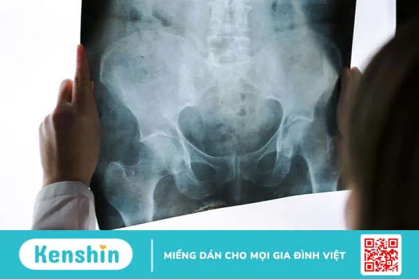 các loại ung thư di căn đến xương phổ biến nhất 3