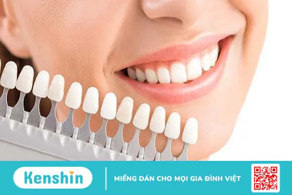 Các tông màu của răng sứ thông dụng hiện nay 1