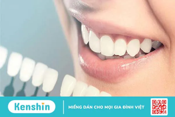 Các tông màu của răng sứ thông dụng hiện nay 3