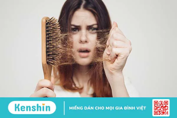 Cách điều trị bệnh rụng tóc sau sinh 2