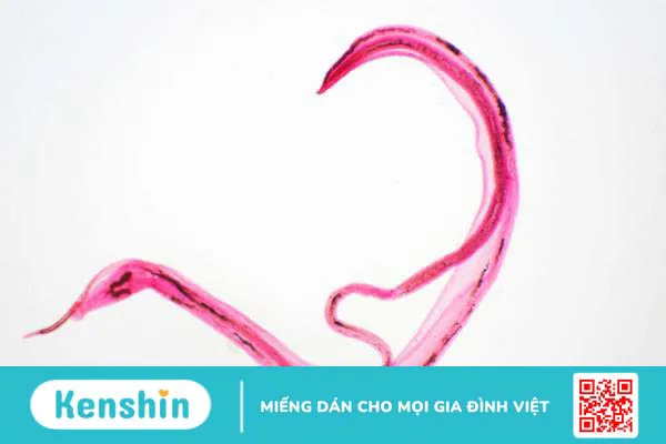 Dự phòng giun sán cho trẻ em1