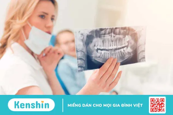 Cách làm giảm sưng nướu răng khôn, hạn chế đau nhức 2