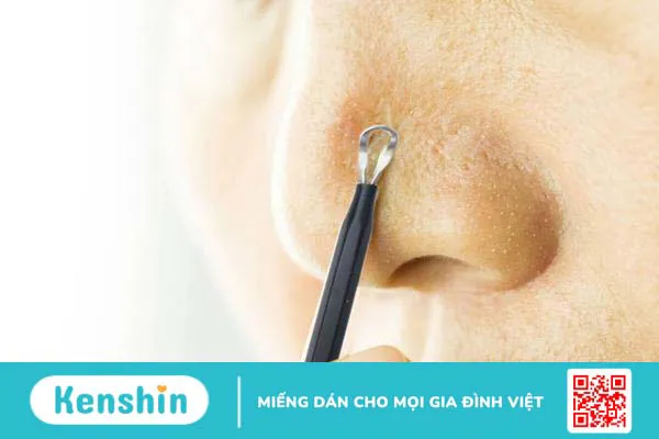 Cách nặn mụn bằng cây nặn mụn mà bạn nên biết 3