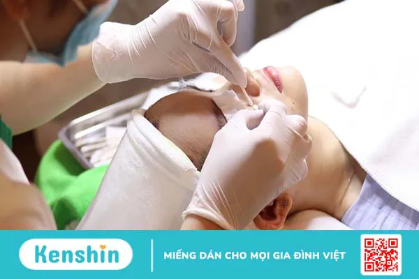 Cách nặn mụn bọc an toàn và không gây sẹo 3