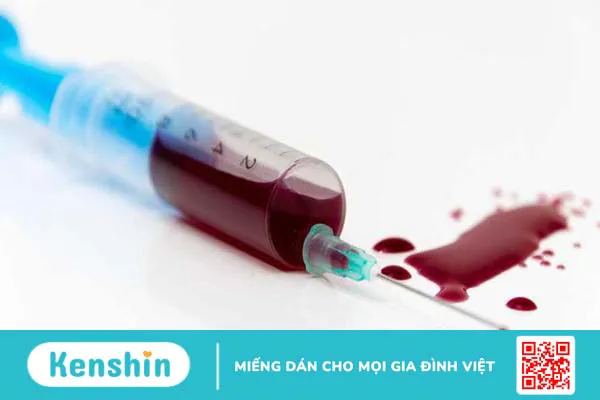 Cách phòng chống HIV giúp bạn kiểm soát tốt nguy cơ mắc bệnh 3