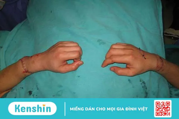 Cách sơ cứu và bảo quản chi thể đứt rời 2