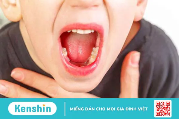 Cảm giác nghẹn cổ họng nhưng ăn uống bình thường 2